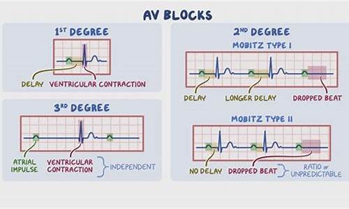 av动漫源码_动漫api接口源码