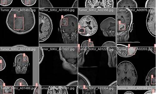 癌症图像识别源码_癌症图像检测识别