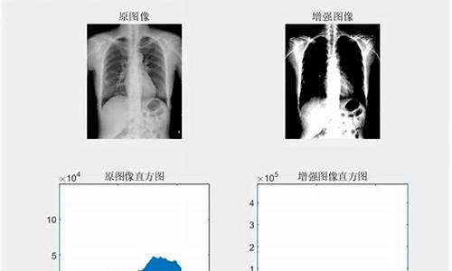 胸片指标源码_胸片代号